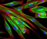 What is the Extracellular Matrix?