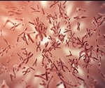 RNAi Applications