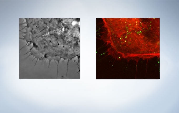 HeLa cell expressing mCherry-actin