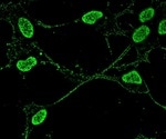 Study sheds light on a key protein associated with brain diseases and dementia