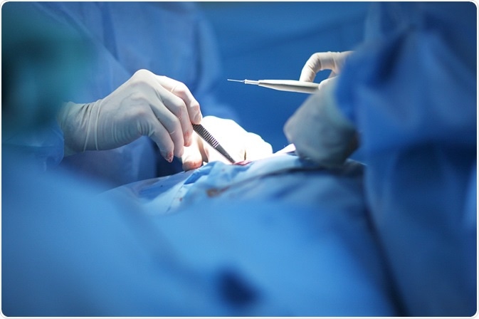 Surgery