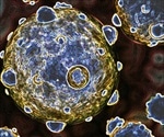 FFF-MALS-DLS for analysis of exosomes