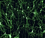 Study uncovers new target in Parkinson’s disease