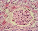 Novel screening tool aids search for curative kidney treatment