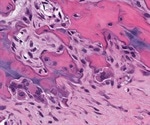 What are Osteoclasts?