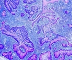 Rous Sarcoma Virus (RSV)