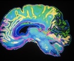 Wearable brain scanner enables brain imaging whilst moving