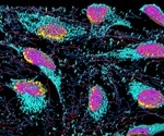Researchers use 3D jet writer to model metastatic cancer