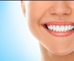 Tartar Causes