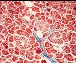 Glucagon Signaling Pathway