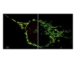 Zeiss highlights 2D superresolution mode for ZEISS Airyscan