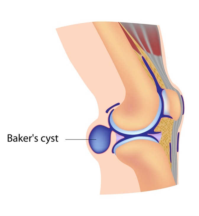 Baker
