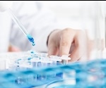 How are Exosomes Isolated?