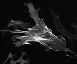 History and Advances of X-Ray Microscopy