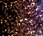Novel biomarker helps optimize anticancer therapy