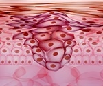 Metastasis Process