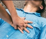 How to Perform CPR