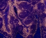Scientists create organoids that could help guide bladder cancer treatment