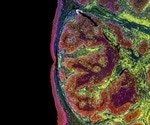 Scientists develop futuristic gene therapy for liver cancer