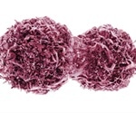 DakoCytomation has acquired exclusive worldwide rights to develop and commercialize pharmacogenomic diagnostic tests in the field of oncology