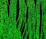 Resistance training enhances cellular recycling in muscle cells