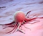 Novel tool successfully predicts outcomes for lung cancer
