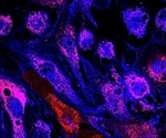 Stem Cell Uses in Research