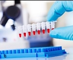 Researchers suggest a theory for the evolution of HIV from SIV