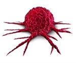 What is Tumor Heterogeneity?