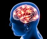 What is Synaesthesia?