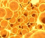 Scientists uncover the cause of insulin resistance in obesity