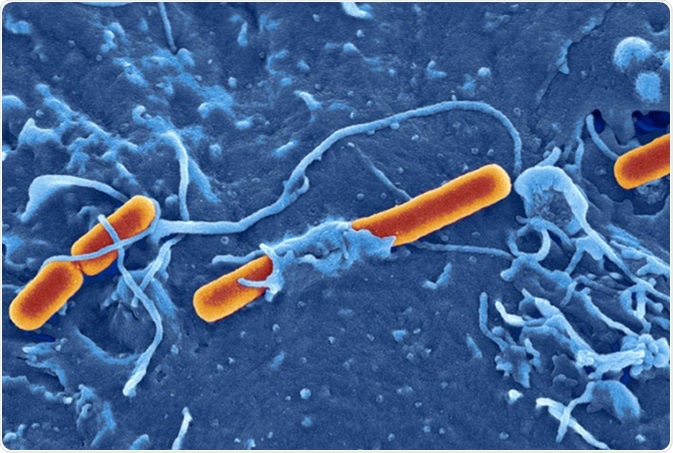 Shigella flexneri - Credit: David Goulding, Wellcome Trust Sanger Institute