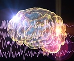 FDA approves cannabis based drug for severe form of epilepsy