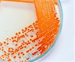 Differentiating Between Microbial Species