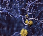 Alzheimer's and Veganism