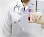 Blood Type Testing