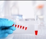 Bladder Cancer Biomarkers
