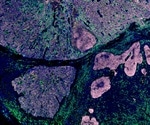 DNA methylation predicts survival outcome in patients with glioma