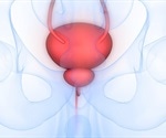 Endoscopic Imaging for Bladder Cancer