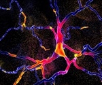 Study reveals how pesticides cause Parkinson's Disease