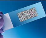 Is Personalized Medicine the Future of Healthcare?