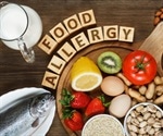 Curcumin-based inhibition of thiol isomerases: A potential treatment for food allergies