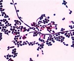 Novel engineered approach makes protein aggregates amenable to spatial manipulations in cells