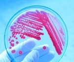 Importance of Phylogeny in Microbiology