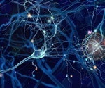 Mayo Clinic study reveals brain cell deficit behind Tourette syndrome