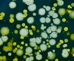 Multiple Gardnerella species coexist in vaginal microbiome, study reveals