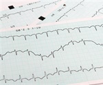 Chinese scientists develop highly efficient process for beta-blocker production
