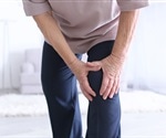 Common anti-inflammatory drugs may aid virus spread