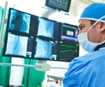 Early TAVR shows greatest stroke reduction in patients aged 65 to 70