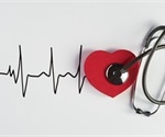 Researchers develop a monitoring technology to identify individual factors provoking atrial fibrillation